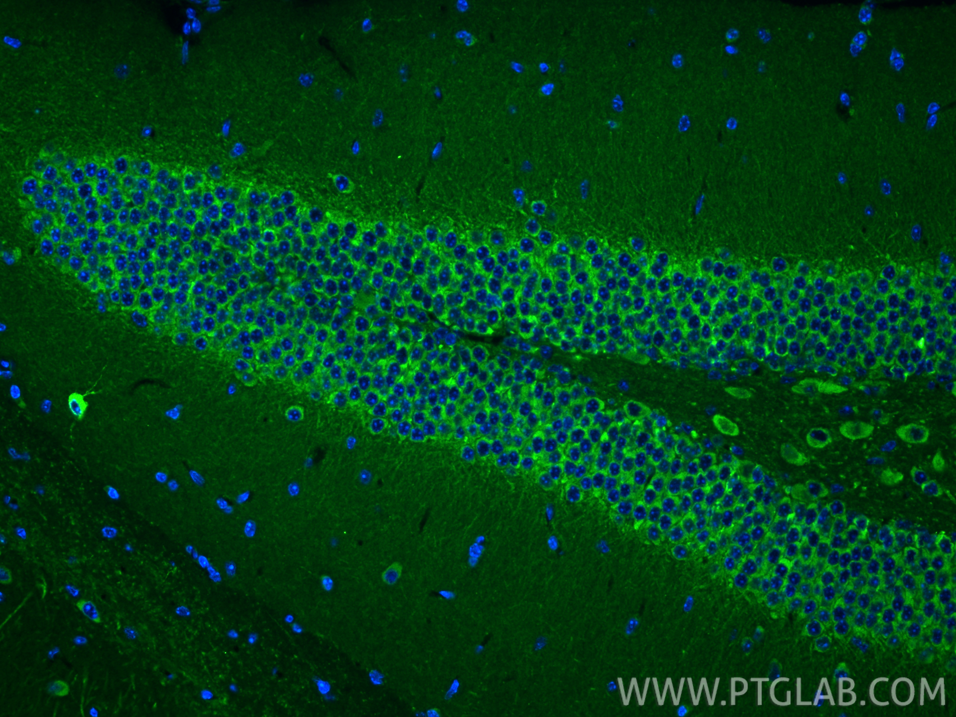 Immunofluorescent analysis of (4% PFA) fixed paraffin-embedded mouse brain tissue using MAP1B antibody (21633-1-AP) at dilution of 1:200 and CoraLite®488-Conjugated Goat Anti-Rabbit IgG(H+L) (<a class='green' href='/productredirect?CatalogNo=SA00013-2' target='_blank'>SA00013-2</a>). Heat mediated antigen retrieval with Tris-EDTA buffer (pH 9.0). IF Staining of mouse brain using 21633-1-AP
