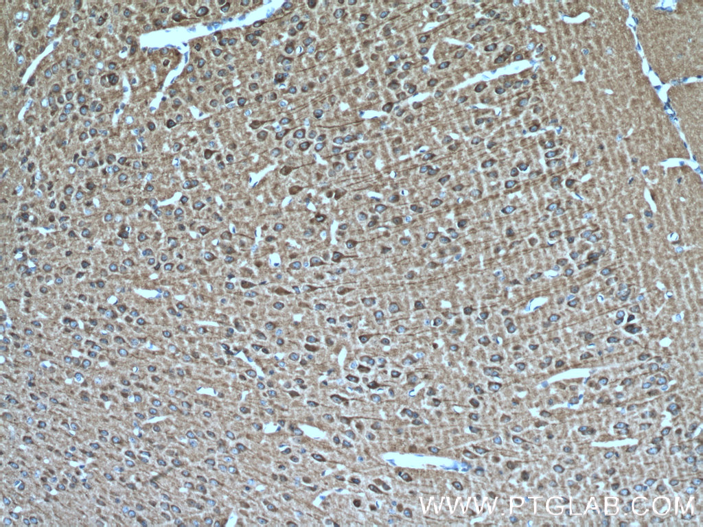 IHC staining of mouse brain using 21633-1-AP