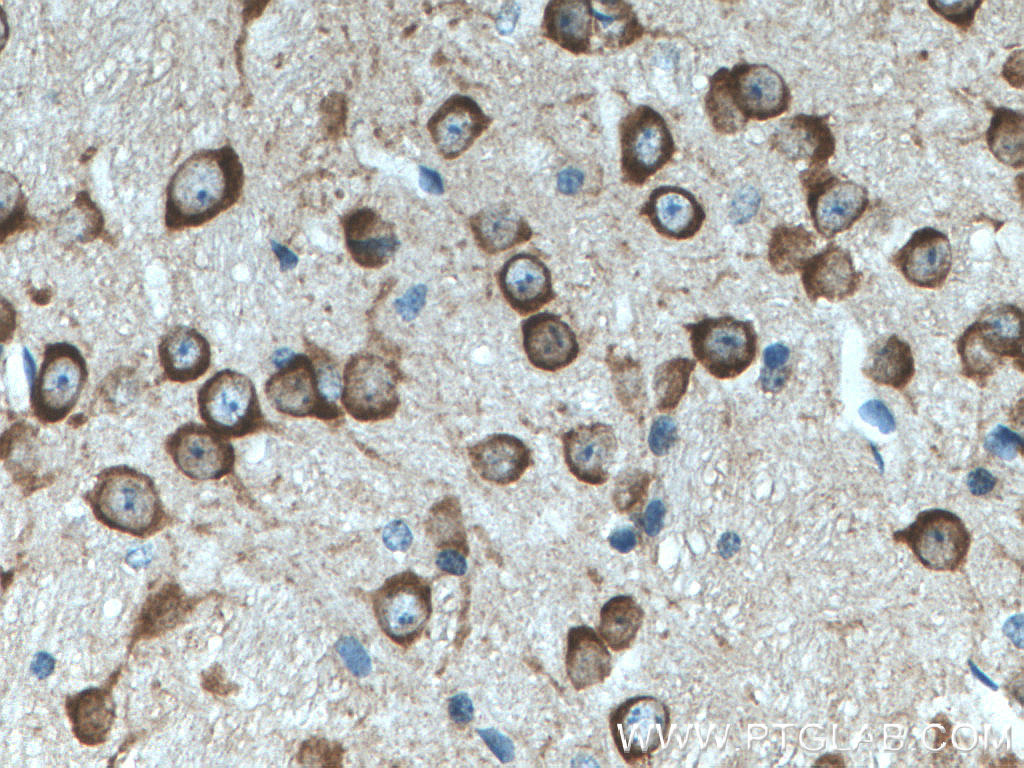 IHC staining of mouse brain using 21633-1-AP