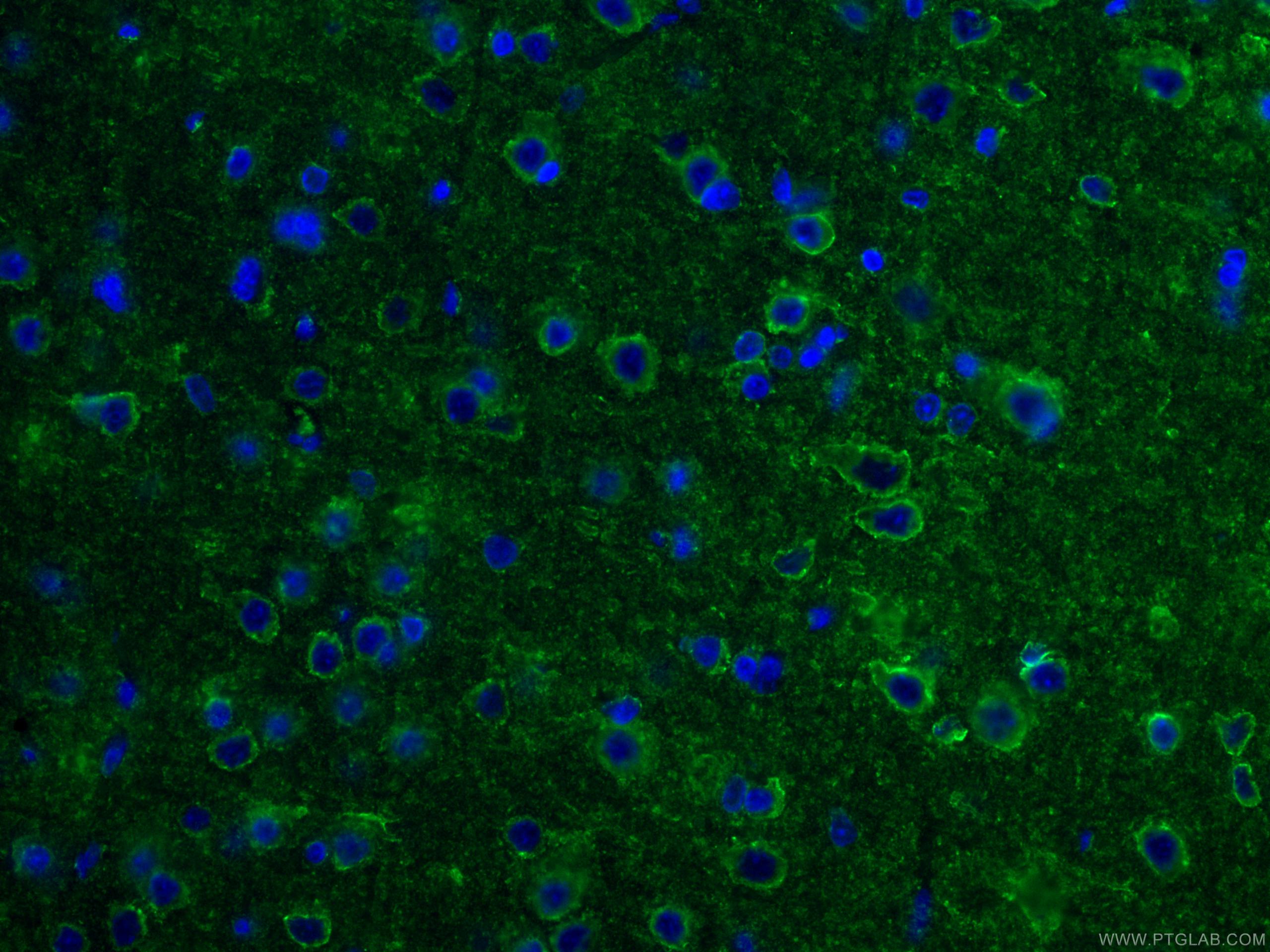 IF Staining of rat brain using 67423-1-Ig (same clone as 67423-1-PBS)