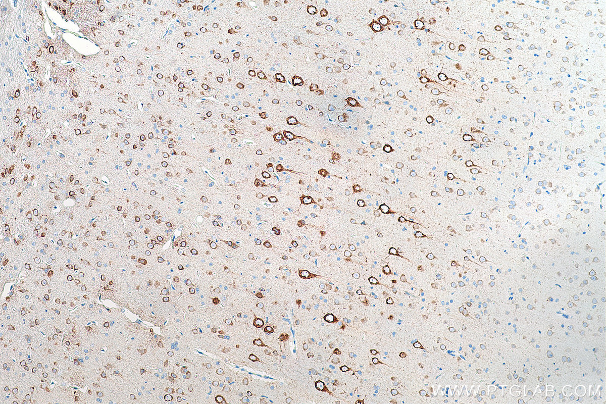 IHC staining of rat brain using 67423-1-Ig (same clone as 67423-1-PBS)