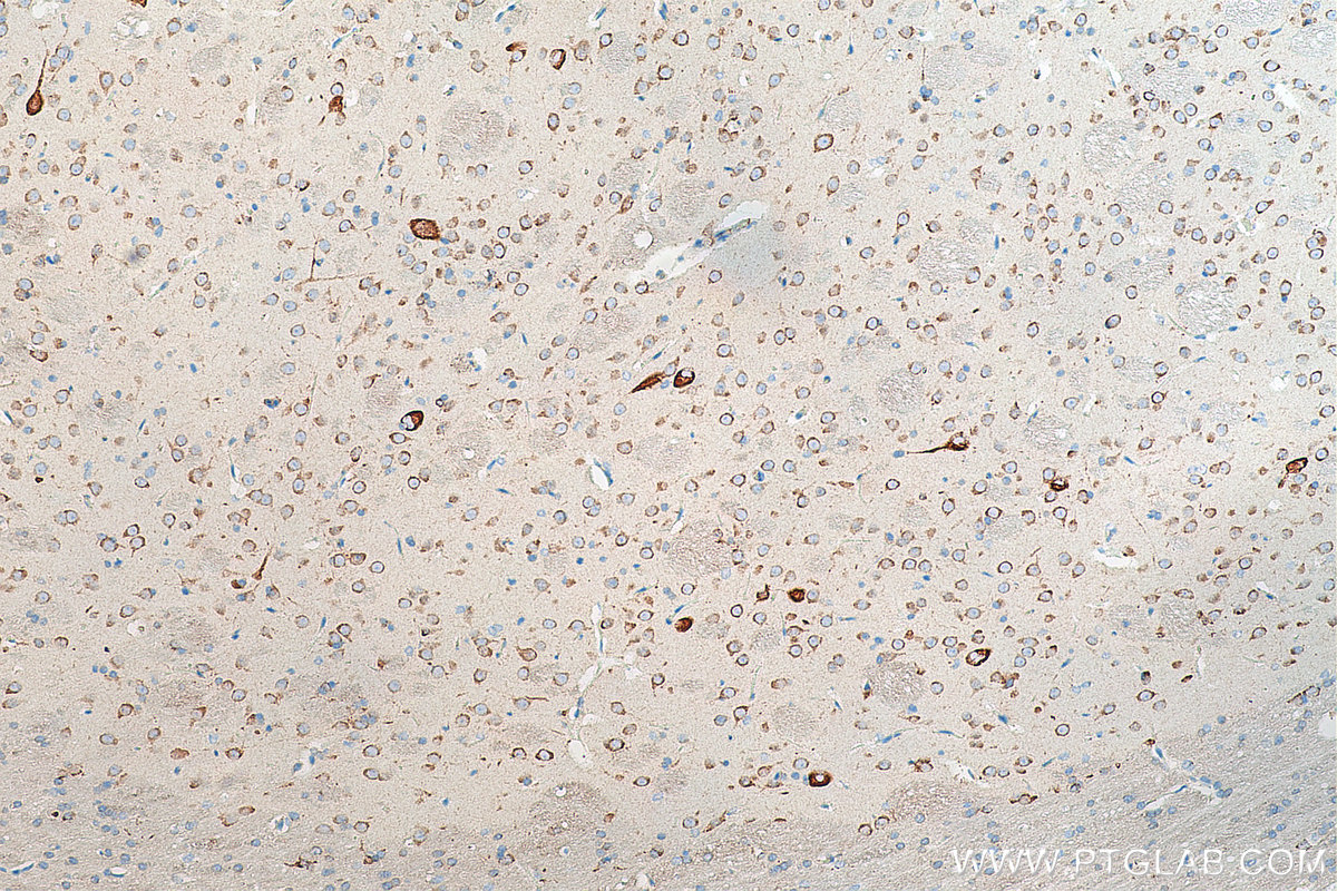 IHC staining of rat brain using 67423-1-Ig (same clone as 67423-1-PBS)