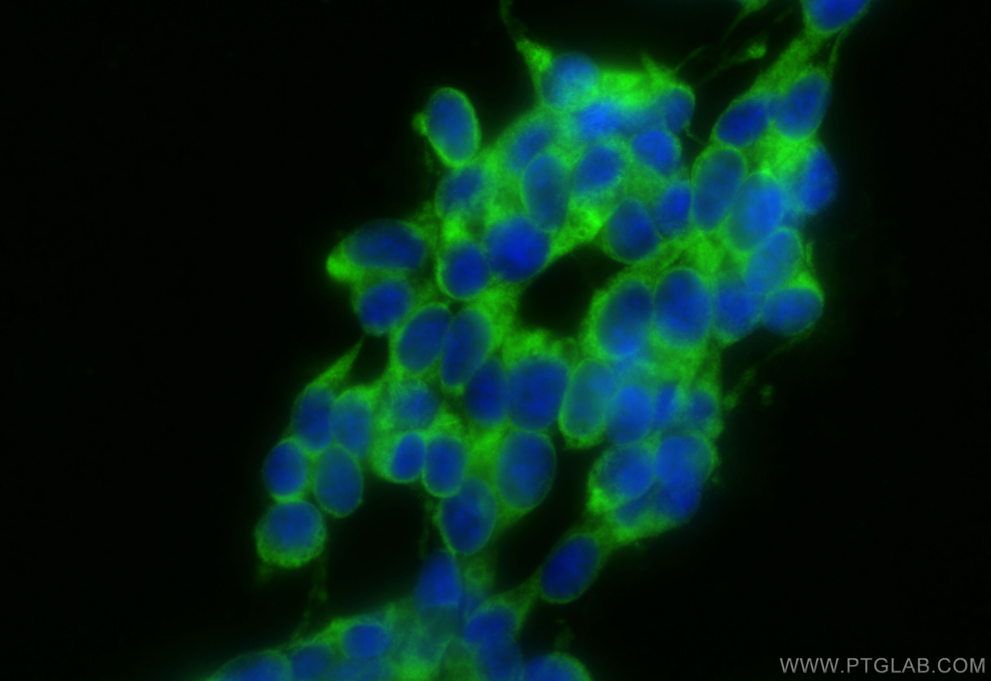 Immunofluorescent analysis of (-20°C Ethanol) fixed SH-SY5Y cells using CoraLite® Plus 488 MAP1B antibody (CL488-21633) at dilution of 1:200. IF Staining of SH-SY5Y using CL488-21633