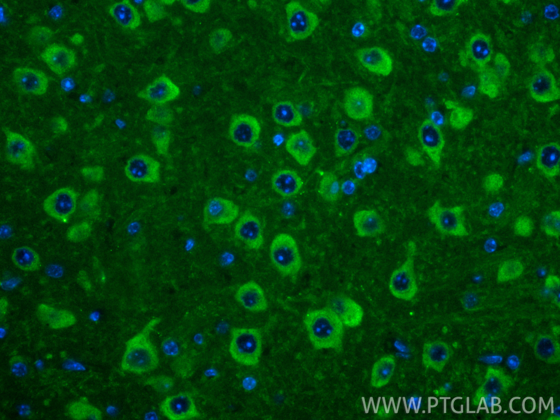 Immunofluorescent analysis of (4% PFA) fixed paraffin-embedded mouse brain tissue using CoraLite® Plus 488 MAP1B antibody (CL488-21633) at dilution of 1:200. Heat mediated antigen retrieval with Tris-EDTA buffer (pH 9.0). IF Staining of mouse brain using CL488-21633