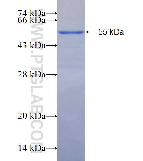 MAP1B fusion protein Ag16255 SDS-PAGE