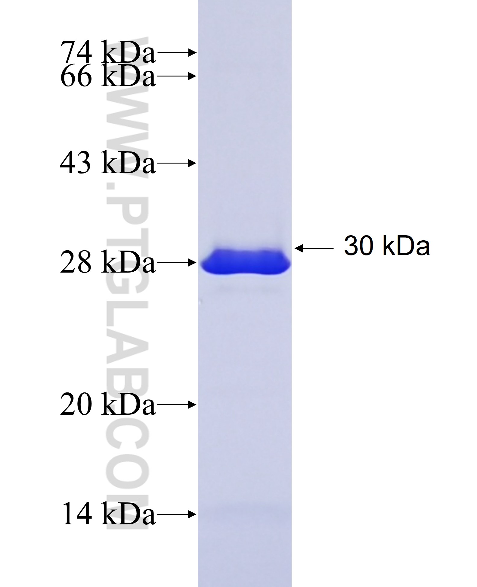 MAP1B fusion protein Ag17709 SDS-PAGE