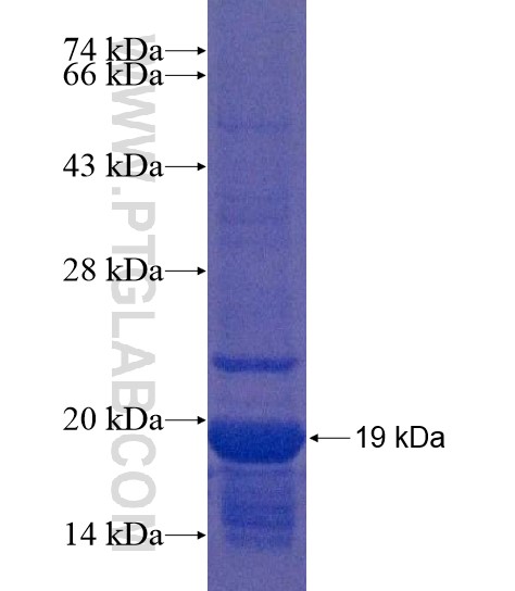MAP1D fusion protein Ag22127 SDS-PAGE