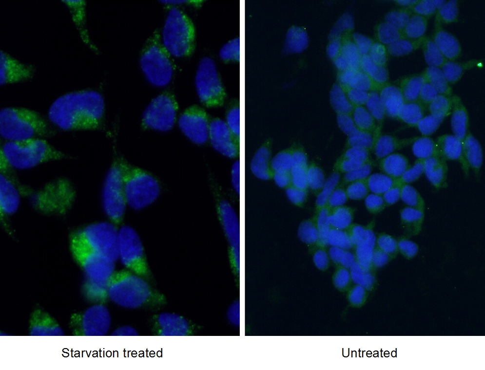 IF Staining of HEK-293 using 12135-1-AP