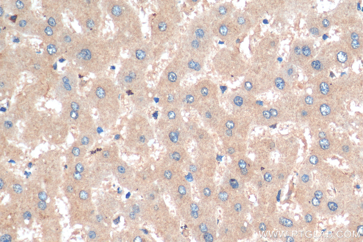 IHC staining of human liver using 14600-1-AP