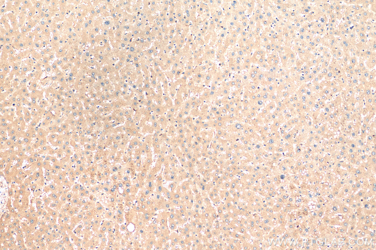 IHC staining of human liver using 14600-1-AP