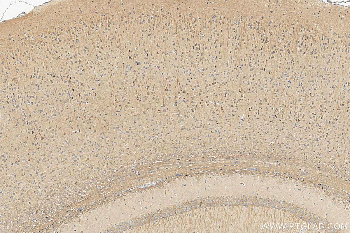 IHC staining of mouse brain using 14600-1-AP IHC staining of mouse brain using 14600-1-AP