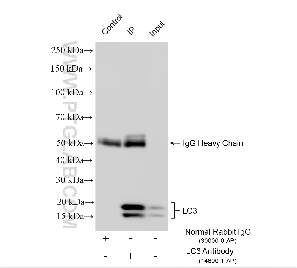 IP experiment of HeLa using 14600-1-AP IP experiment of HeLa using 14600-1-AP