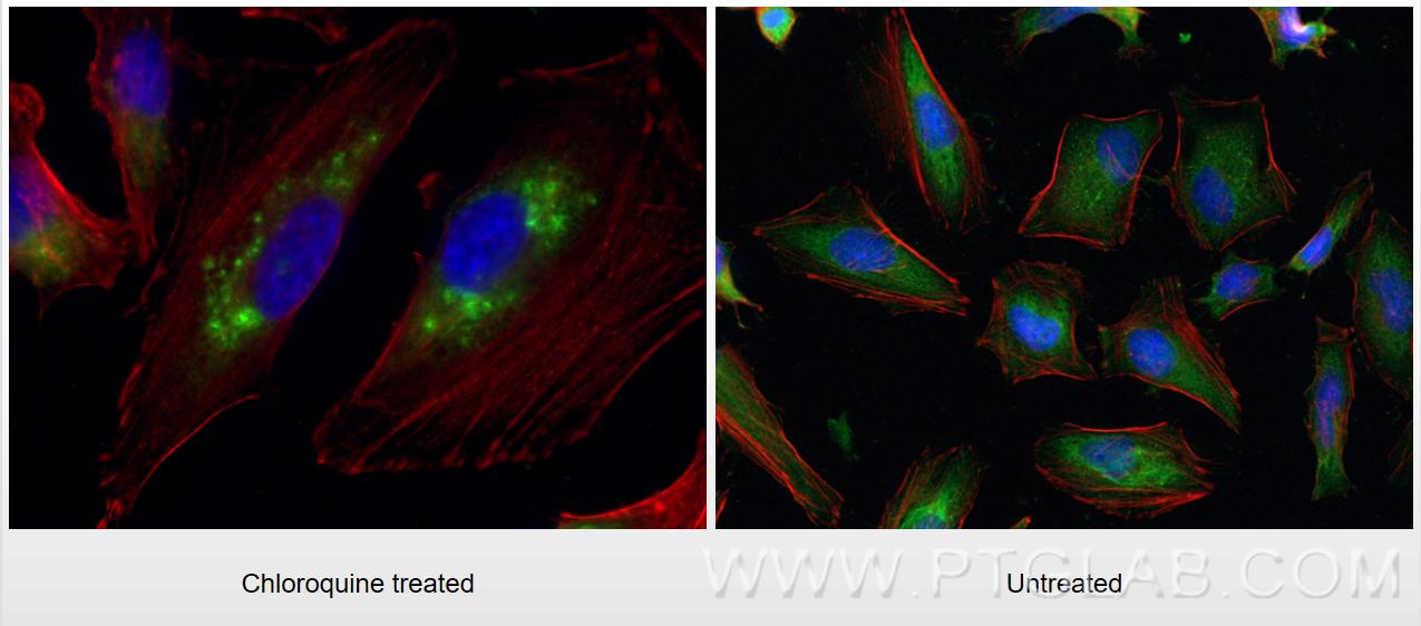 IF Staining of HeLa using 18725-1-AP