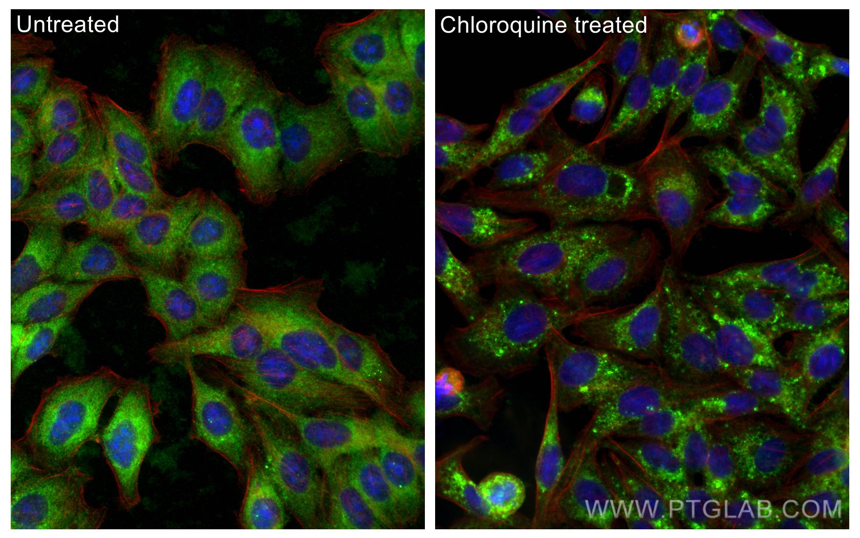 IF Staining of HepG2 using 18725-1-AP