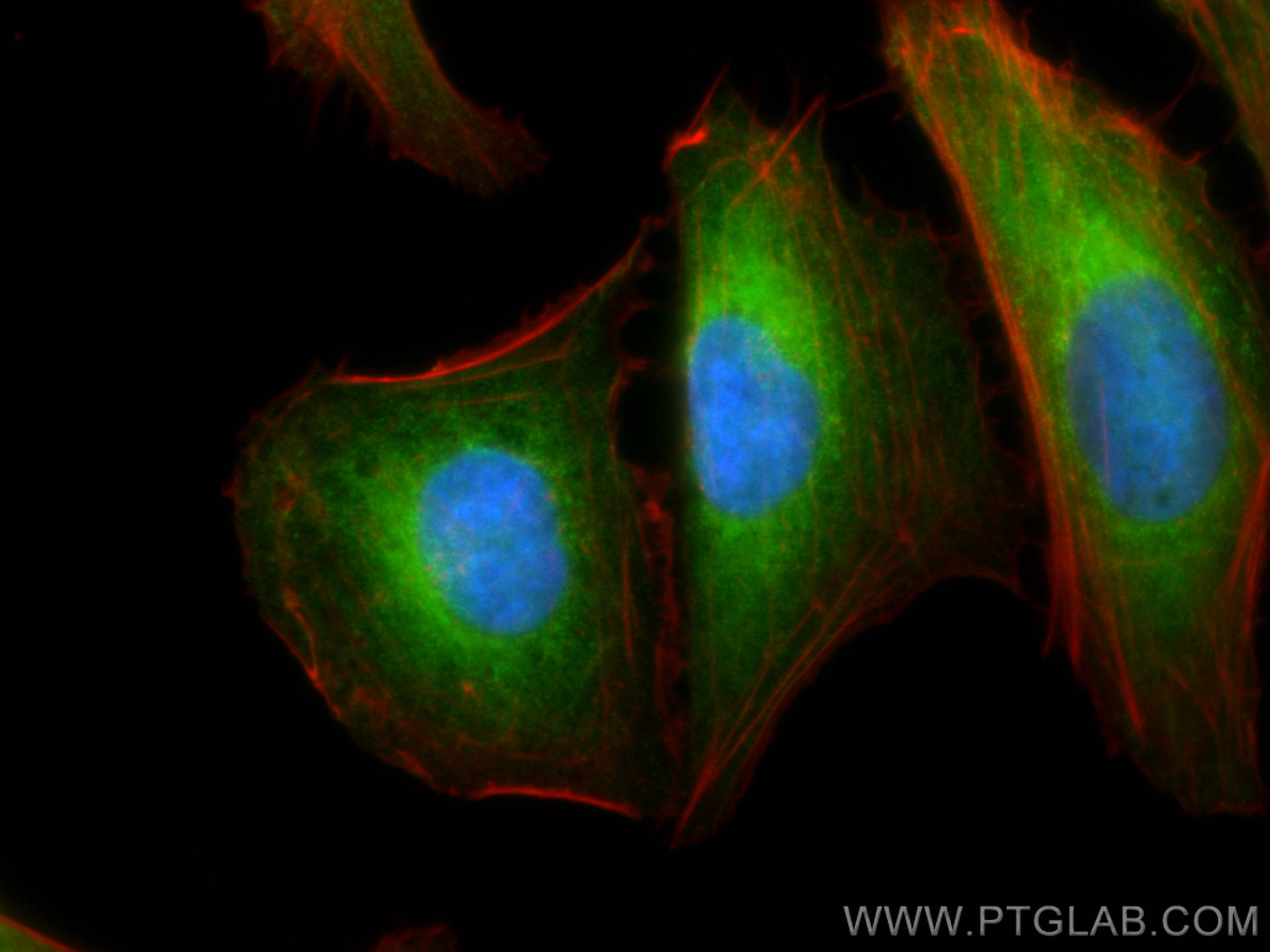 IF Staining of U2OS using 15695-1-AP