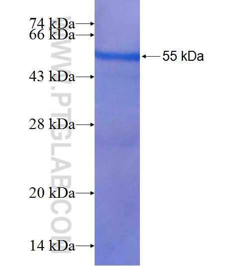 MAP1S fusion protein Ag8315 SDS-PAGE