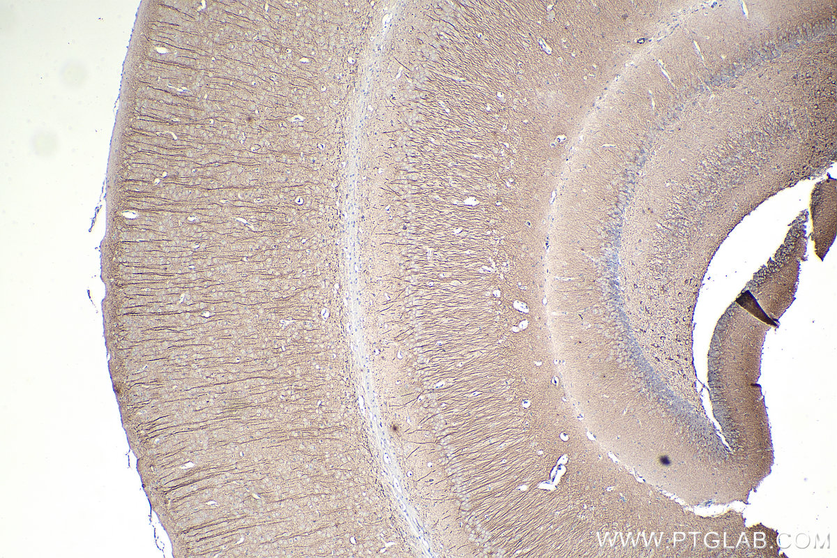 IHC staining of mouse brain using 67015-1-Ig