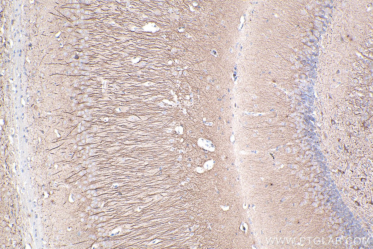 IHC staining of mouse brain using 67015-1-Ig