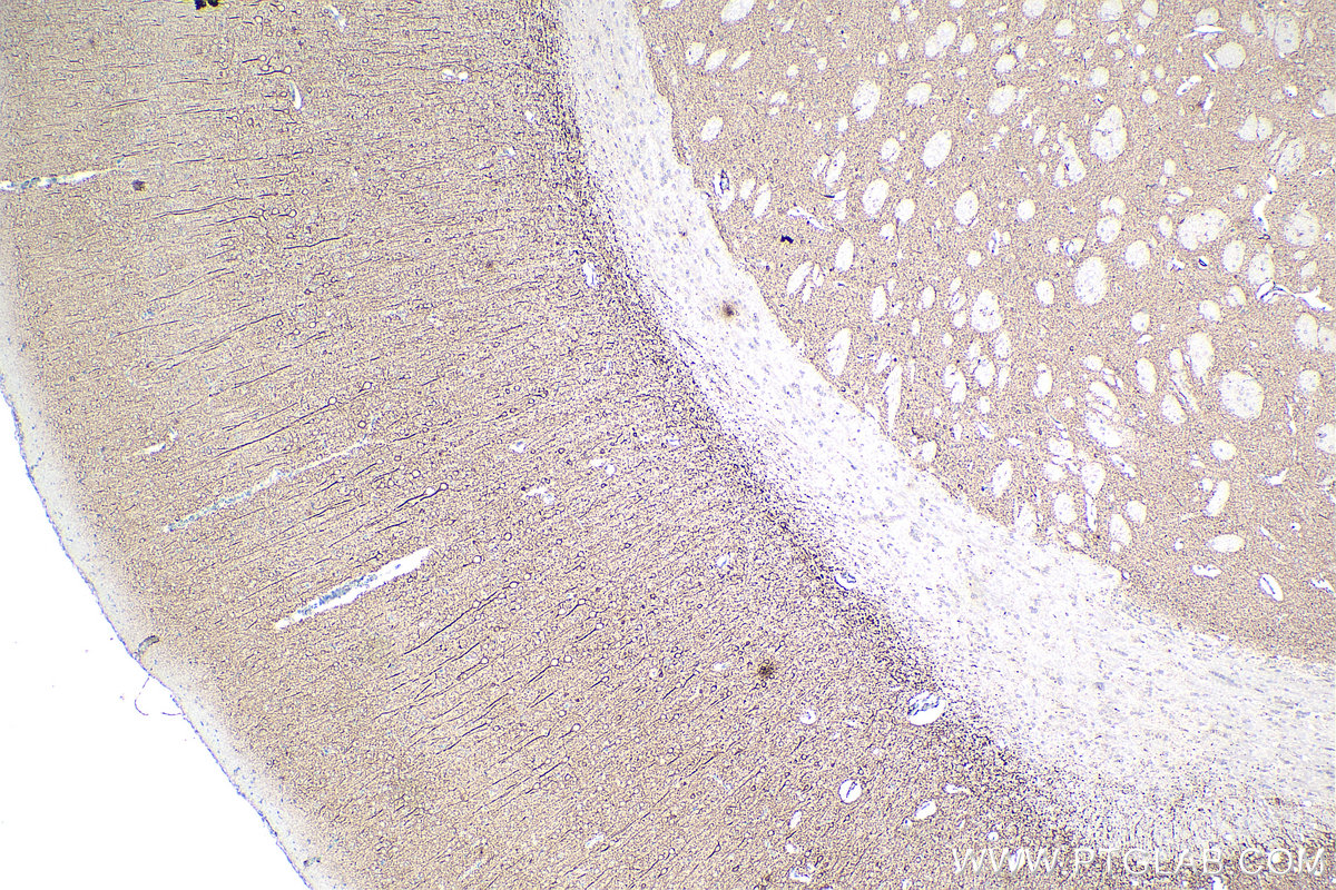 IHC staining of rat brain using 67015-1-Ig