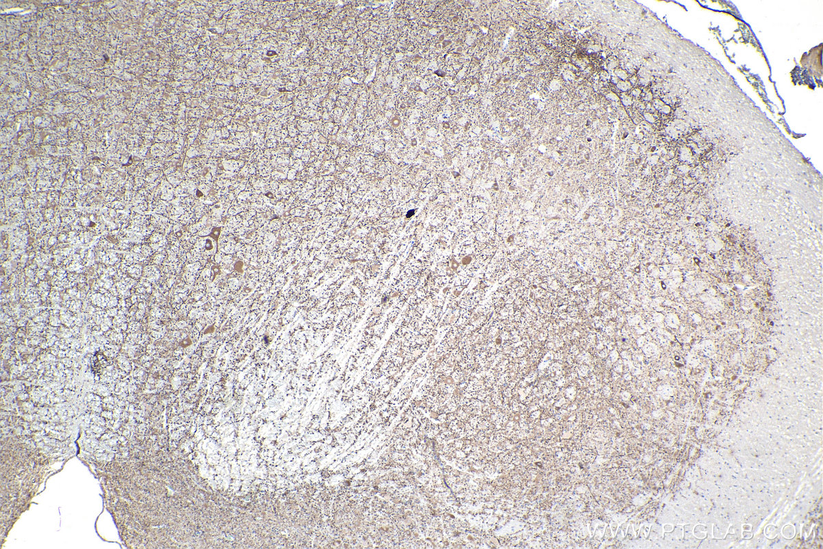 IHC staining of rat cerebellum using 67015-1-Ig