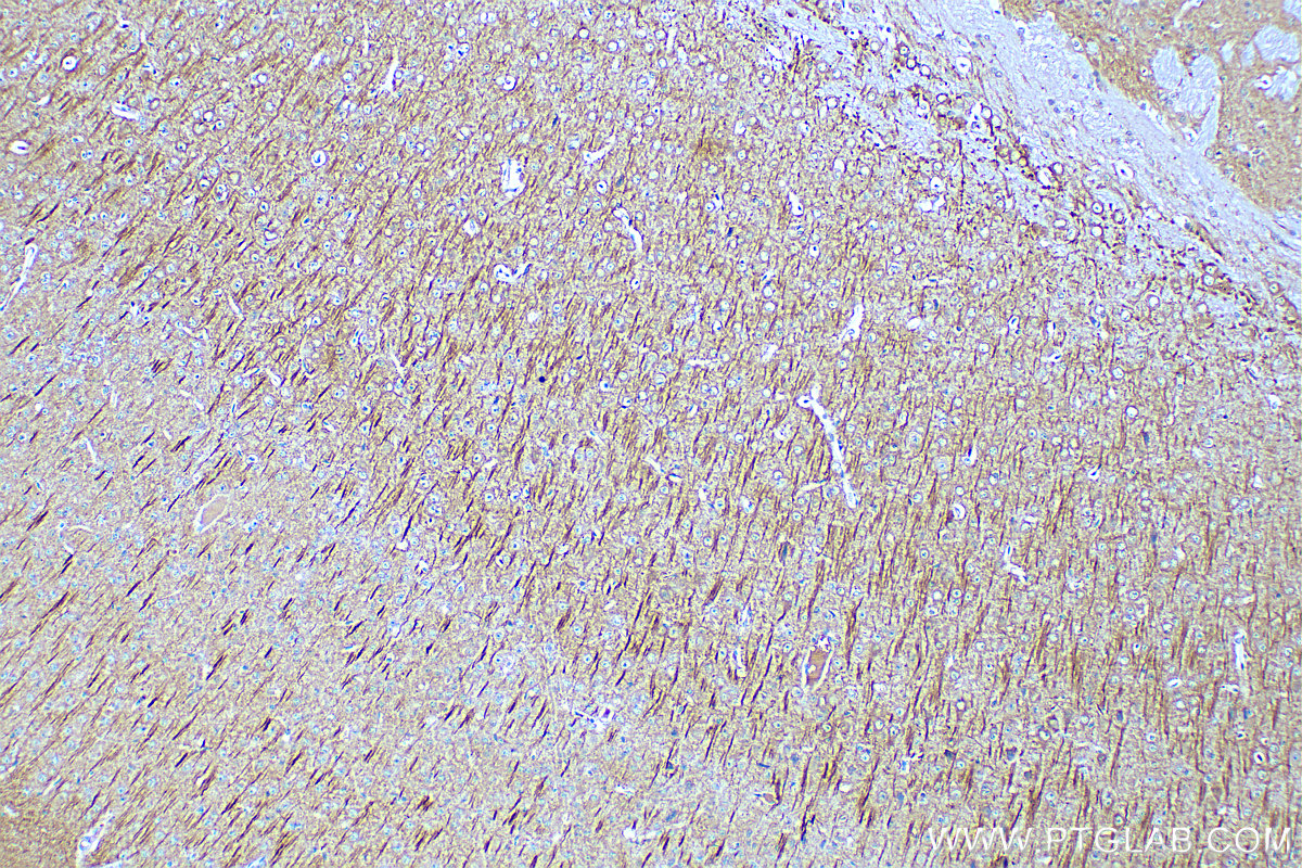 IHC staining of mouse brain using 67015-1-Ig (same clone as 67015-1-PBS)