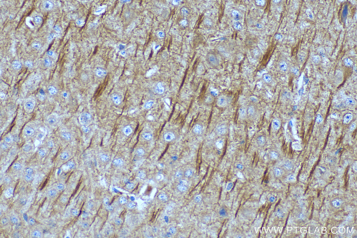 IHC staining of mouse brain using 67015-1-Ig