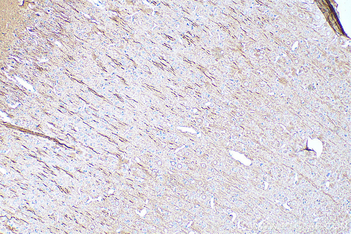 IHC staining of rat brain using 67015-1-Ig (same clone as 67015-1-PBS)