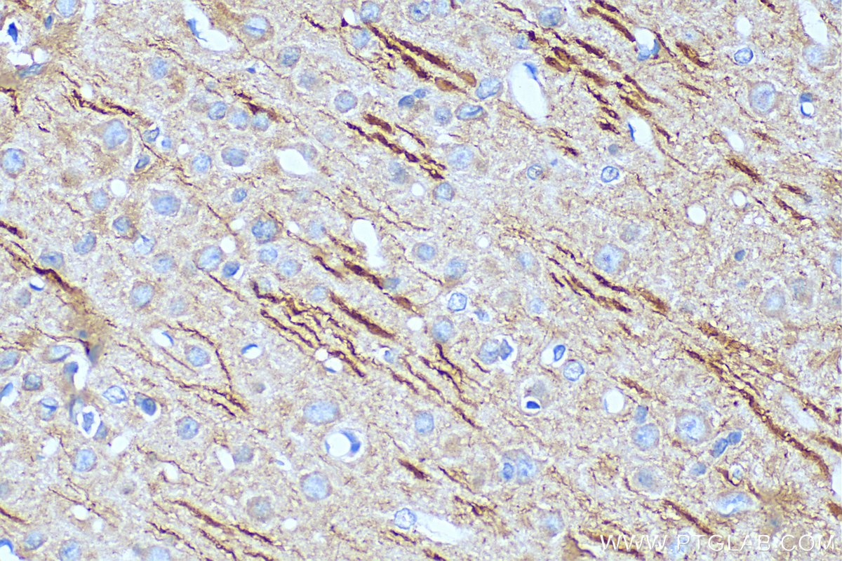 IHC staining of rat brain using 67015-1-Ig (same clone as 67015-1-PBS)