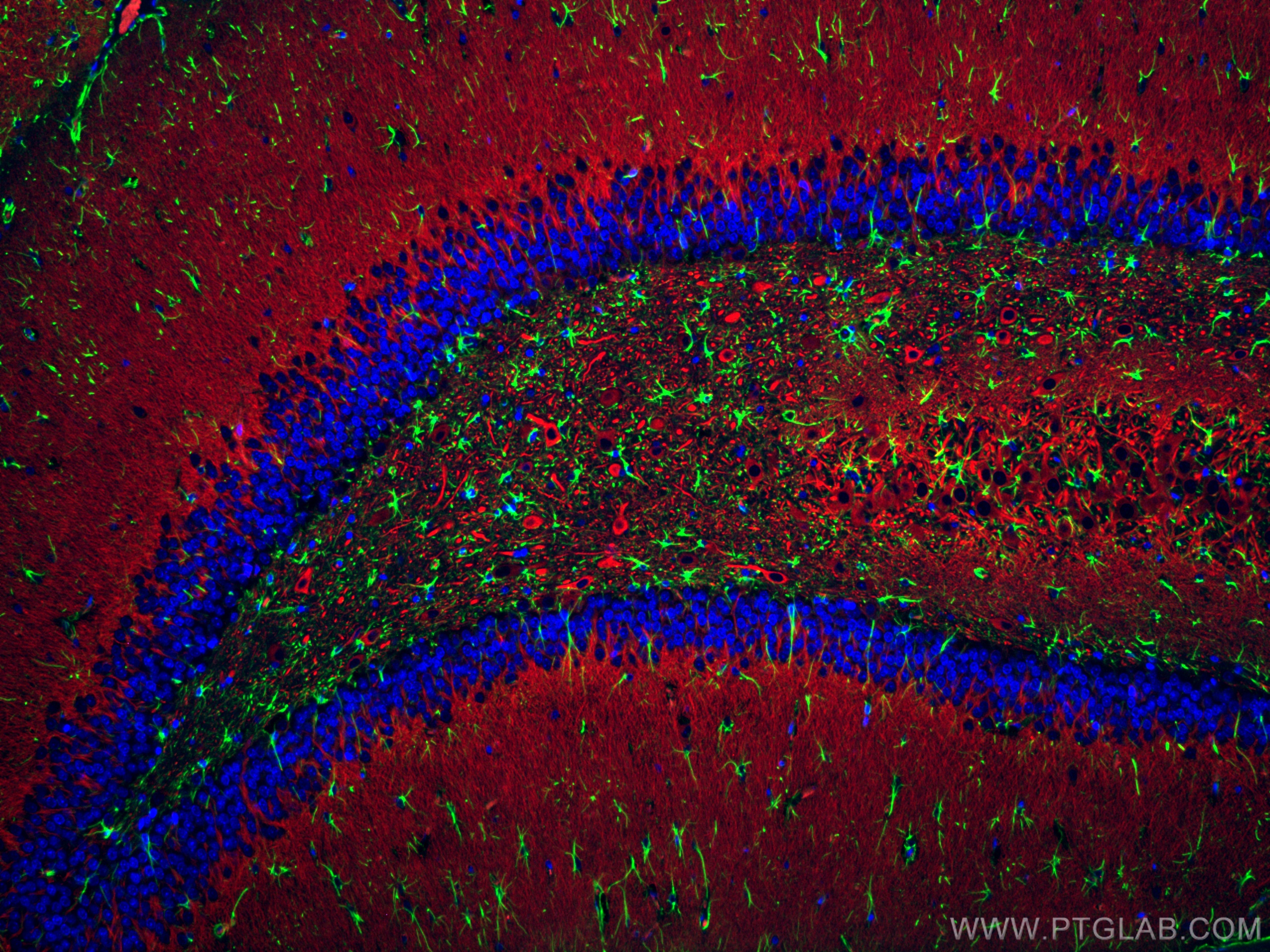 IF Staining of rat brain using CL594-17490