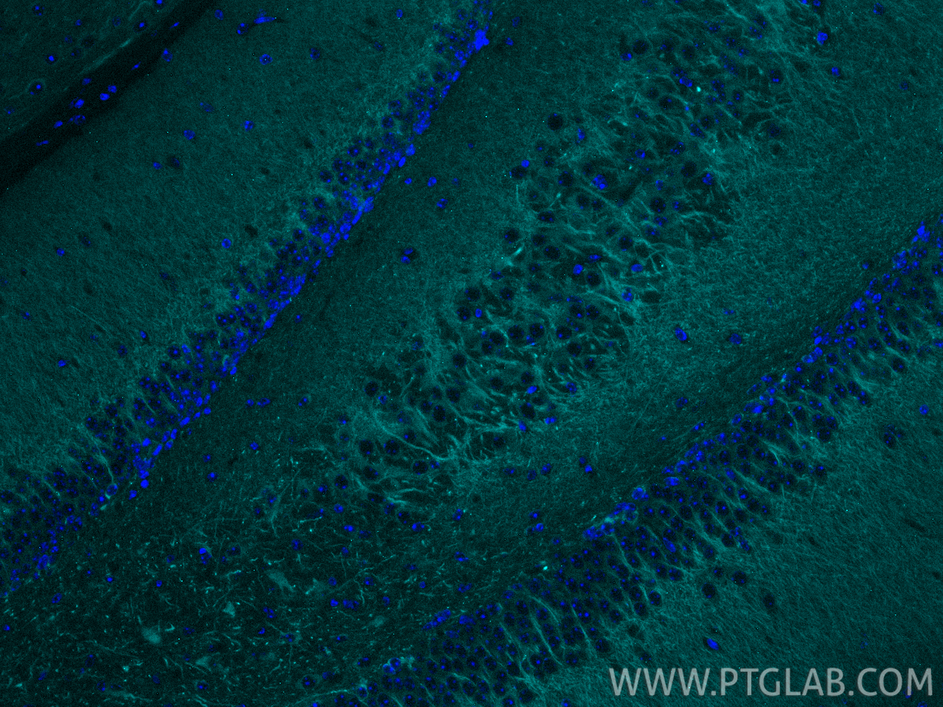 IF Staining of mouse brain using CL750-17490 IF Staining of mouse brain using CL750-17490