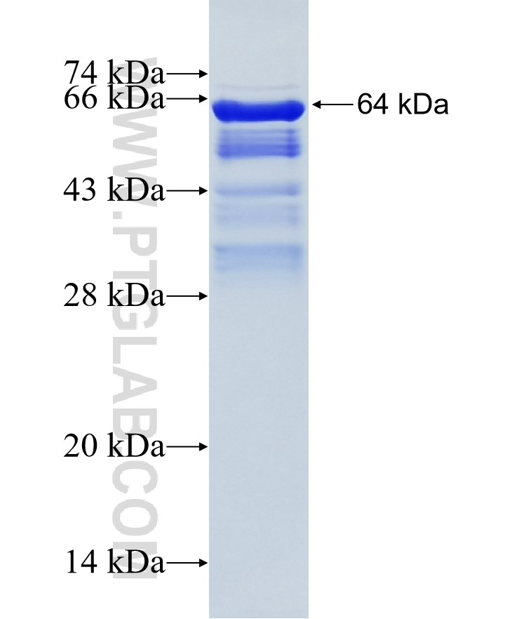 MAP2 fusion protein Ag11580 SDS-PAGE