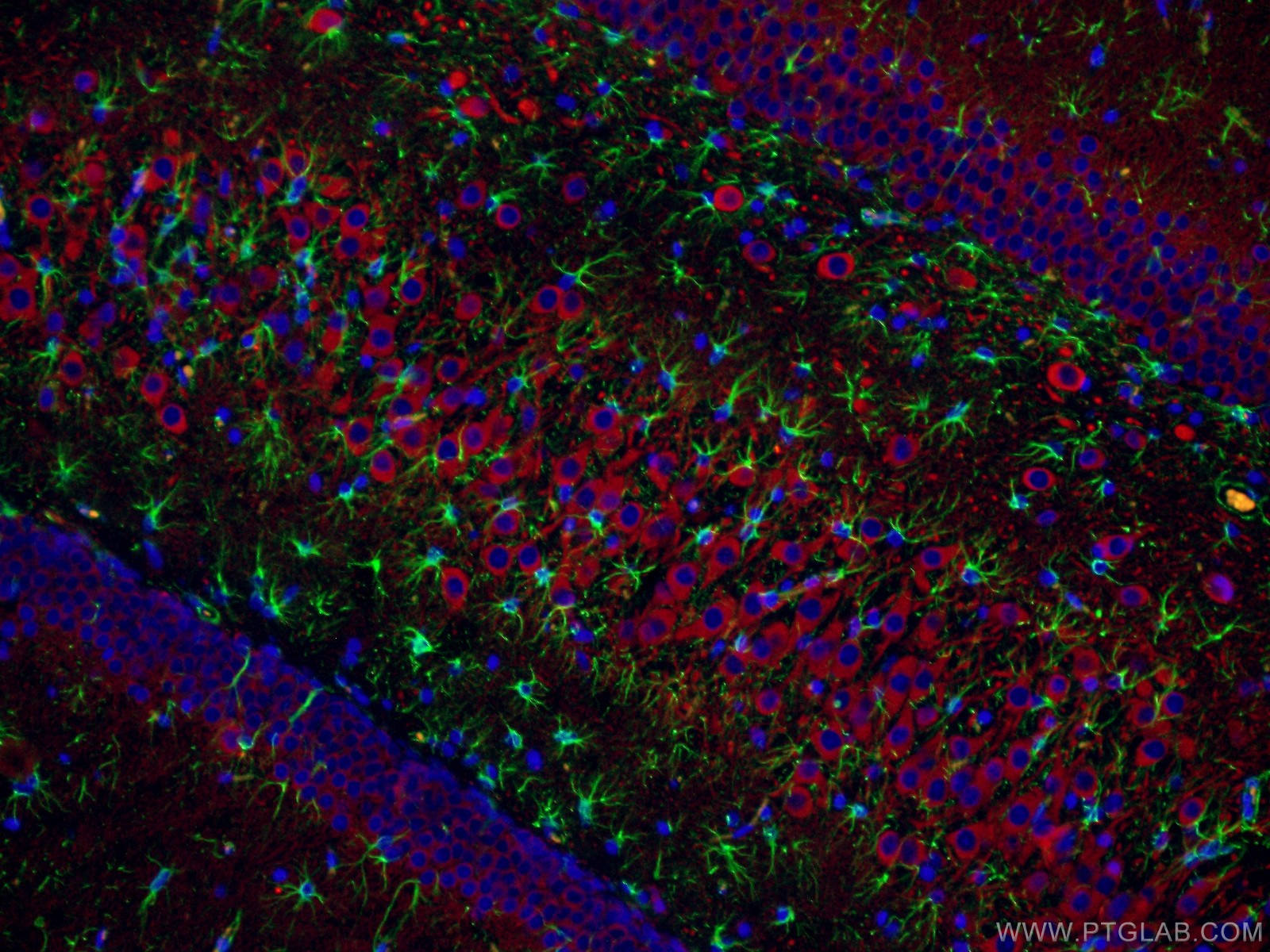 IF Staining of rat brain using 17490-1-AP