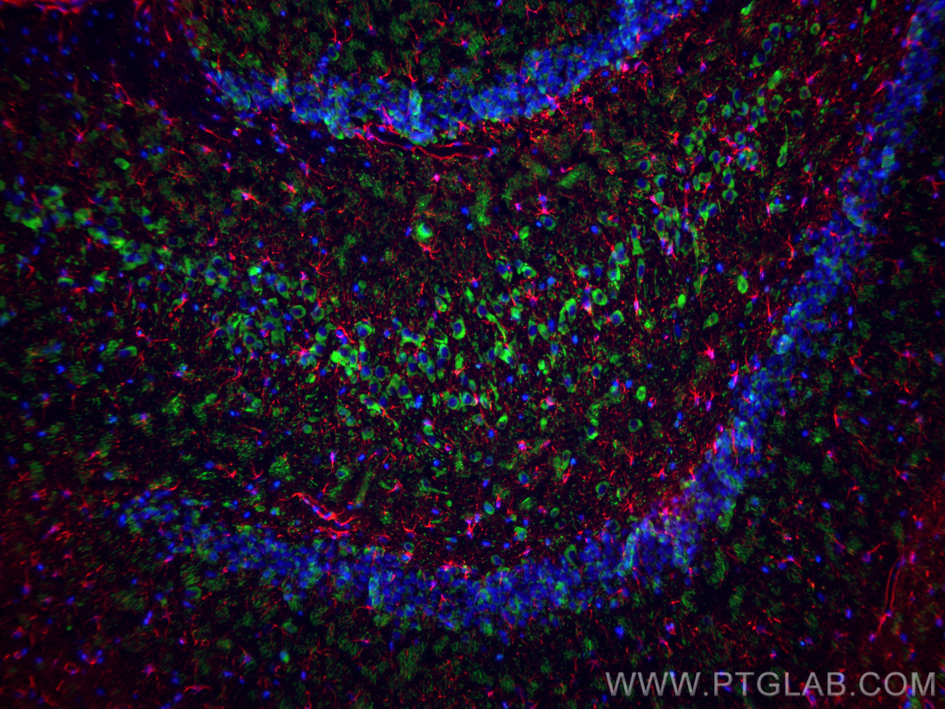IF Staining of rat brain using 17490-1-AP