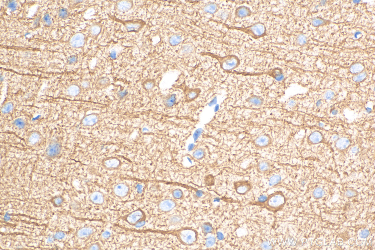 IHC staining of mouse brain using 17490-1-AP