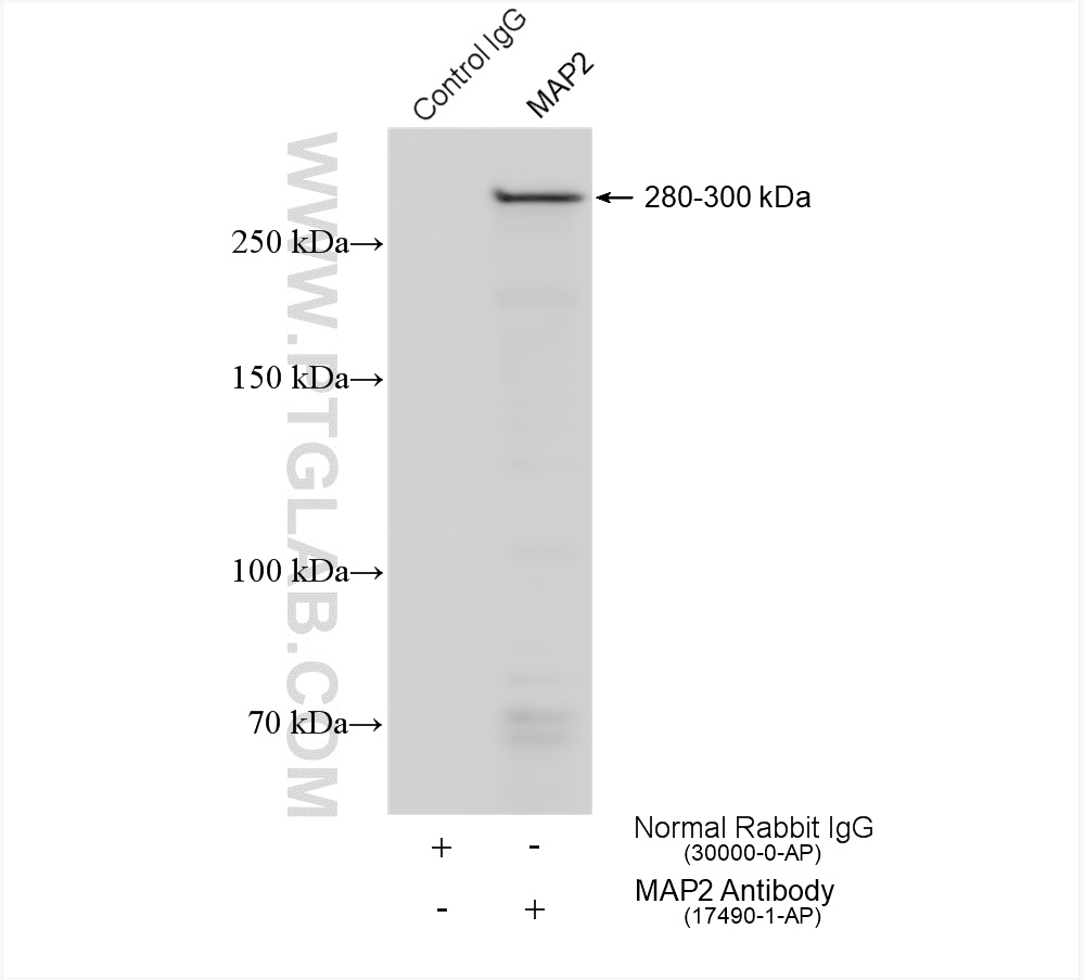 IP experiment of mouse brain using 17490-1-AP