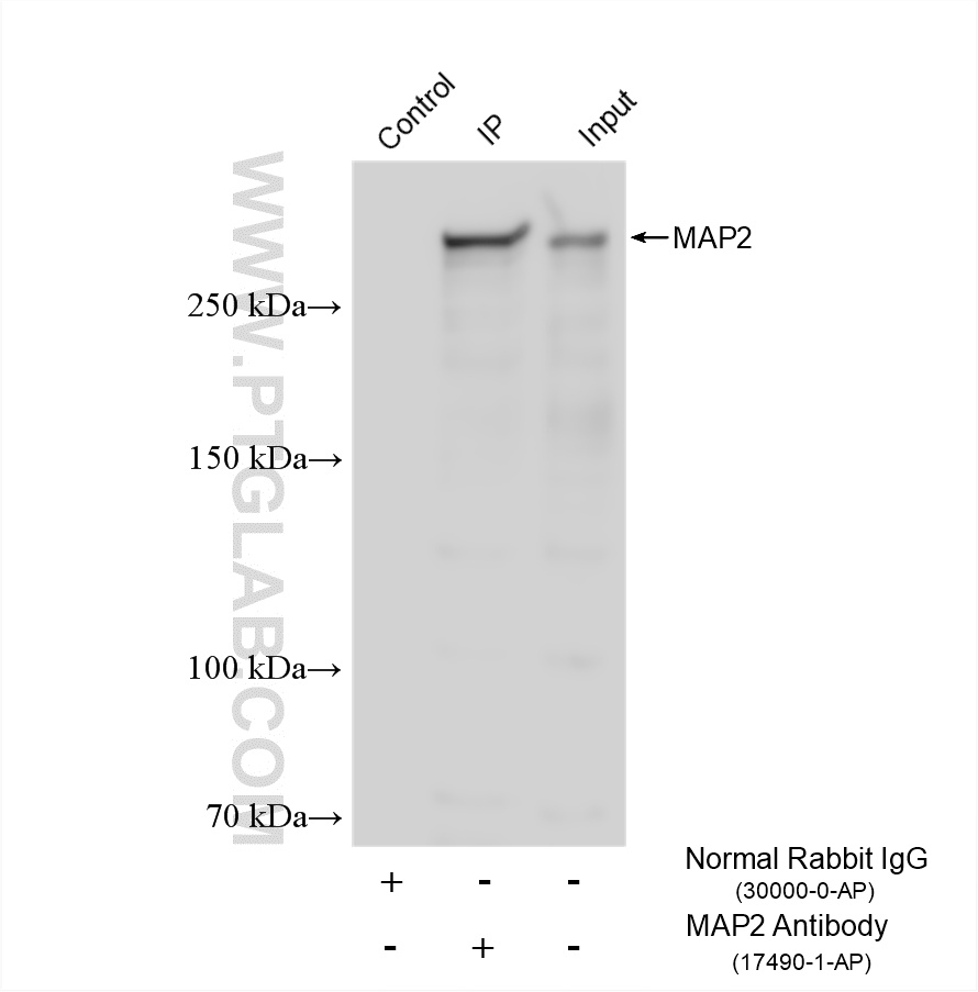 IP experiment of mouse brain using 17490-1-AP IP experiment of mouse brain using 17490-1-AP
