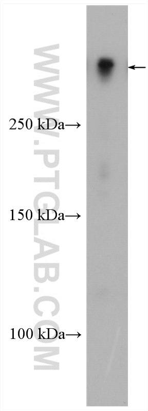 WB analysis of rat brain using 17490-1-AP