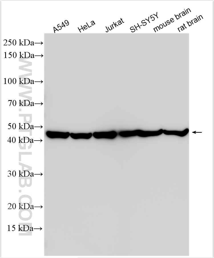 WB analysis using 11049-1-AP