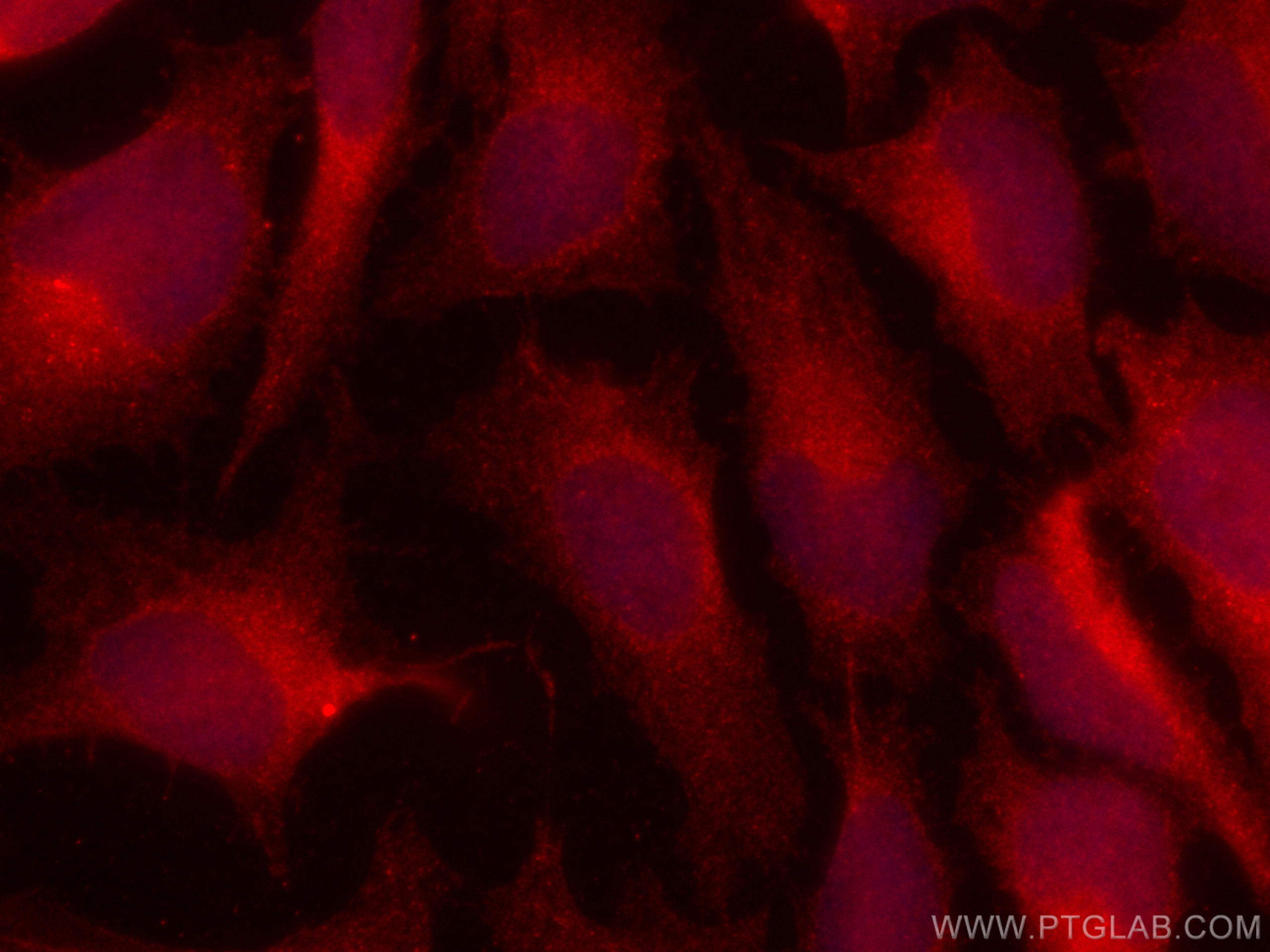 IF Staining of HeLa using CL594-80137