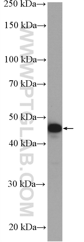 WB analysis of mouse brain using 51142-1-AP