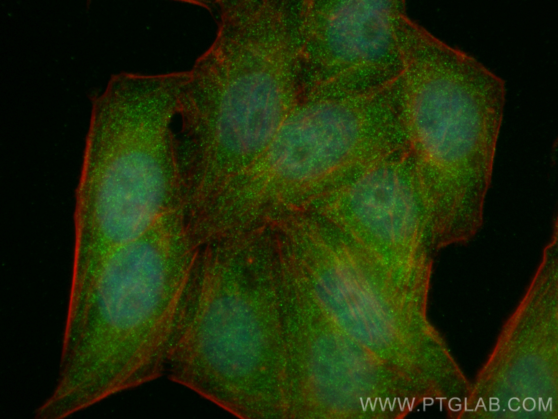 IF Staining of HepG2 using 67333-1-Ig (same clone as 67333-1-PBS)