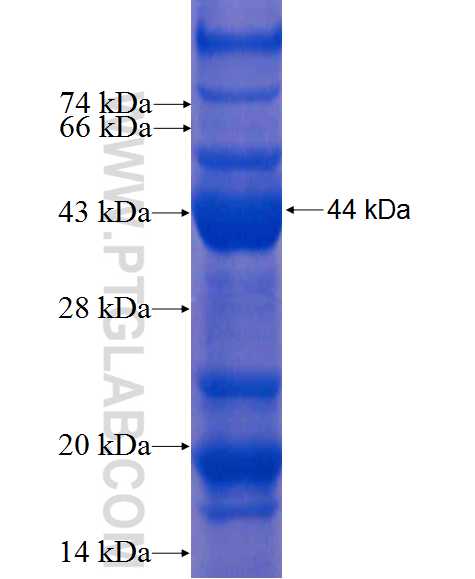 MAP2K5 fusion protein Ag8619 SDS-PAGE MAP2K5 fusion protein Ag8619 SDS-PAGE