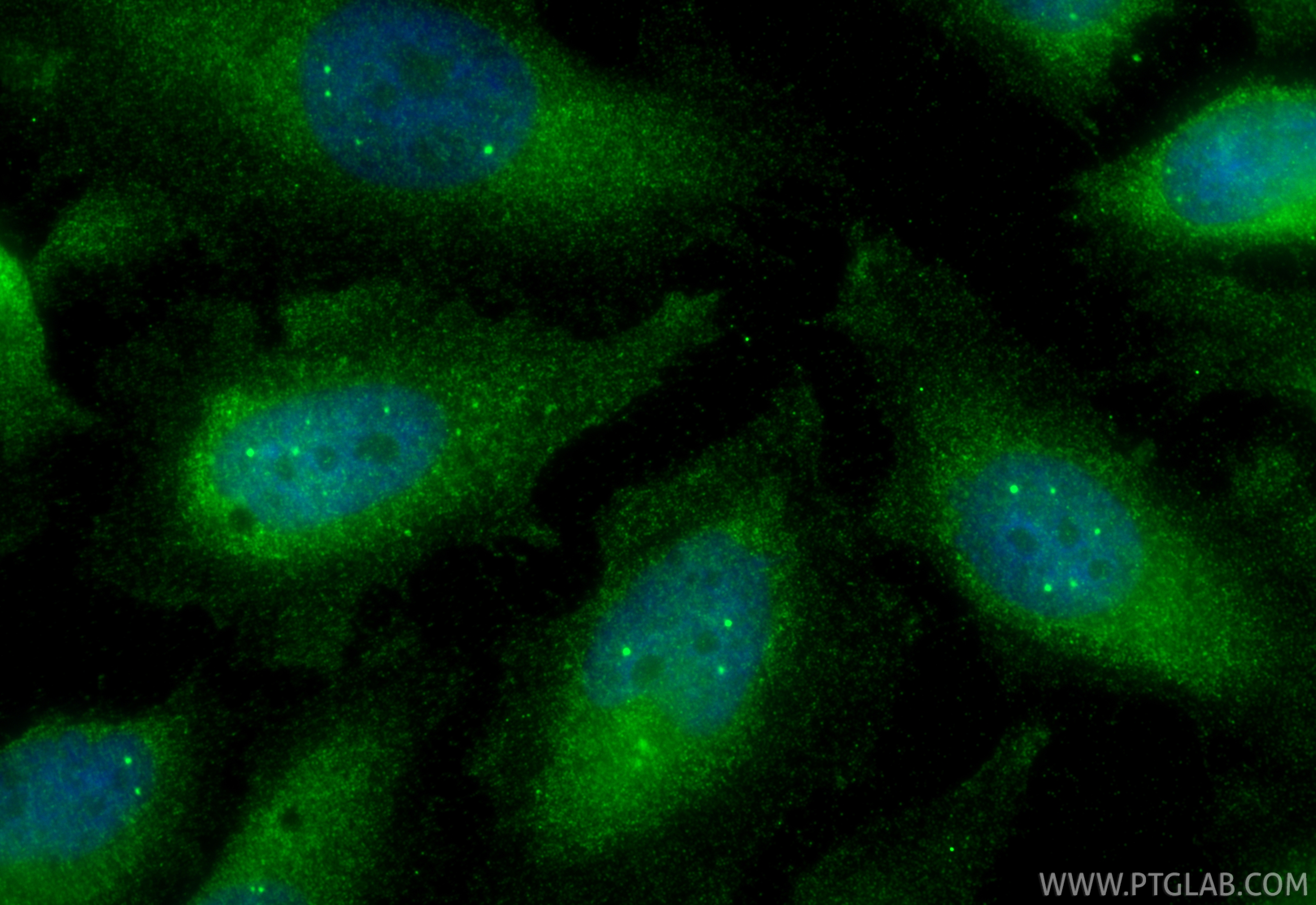 IF Staining of HeLa using 12745-1-AP
