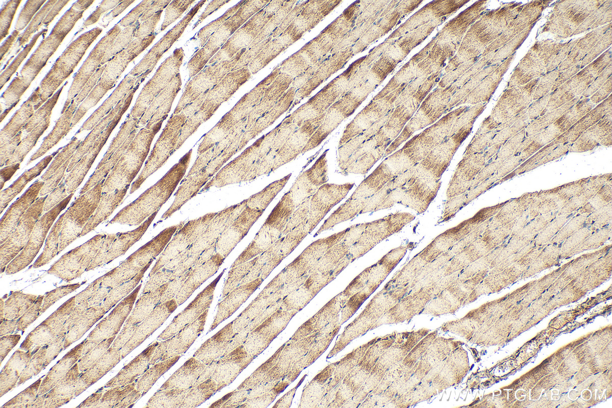 Immunohistochemical analysis of paraffin-embedded rat skeletal muscle tissue slide using 12745-1-AP (MEK6 antibody) at dilution of 1:200 (under 10x lens). Heat mediated antigen retrieval with Tris-EDTA buffer (pH 9.0). IHC staining of rat skeletal muscle using 12745-1-AP