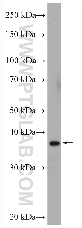 WB analysis of HeLa using 12745-1-AP