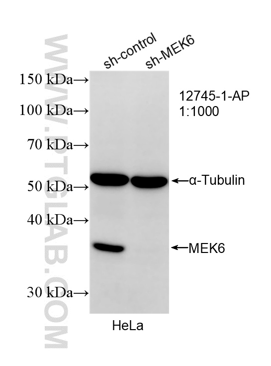 WB result of MEK6 antibody (12745-1-AP; 1:1000; incubated at room temperature for 1.5 hours) with sh-Control and sh-MEK6 transfected HeLa cells. WB analysis of HeLa using 12745-1-AP