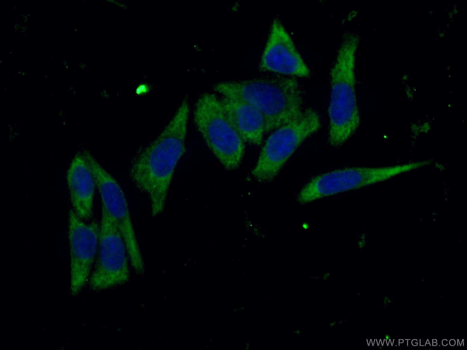 IF Staining of HeLa using 19970-1-AP