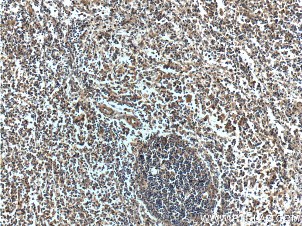 IHC staining of human spleen using 19970-1-AP