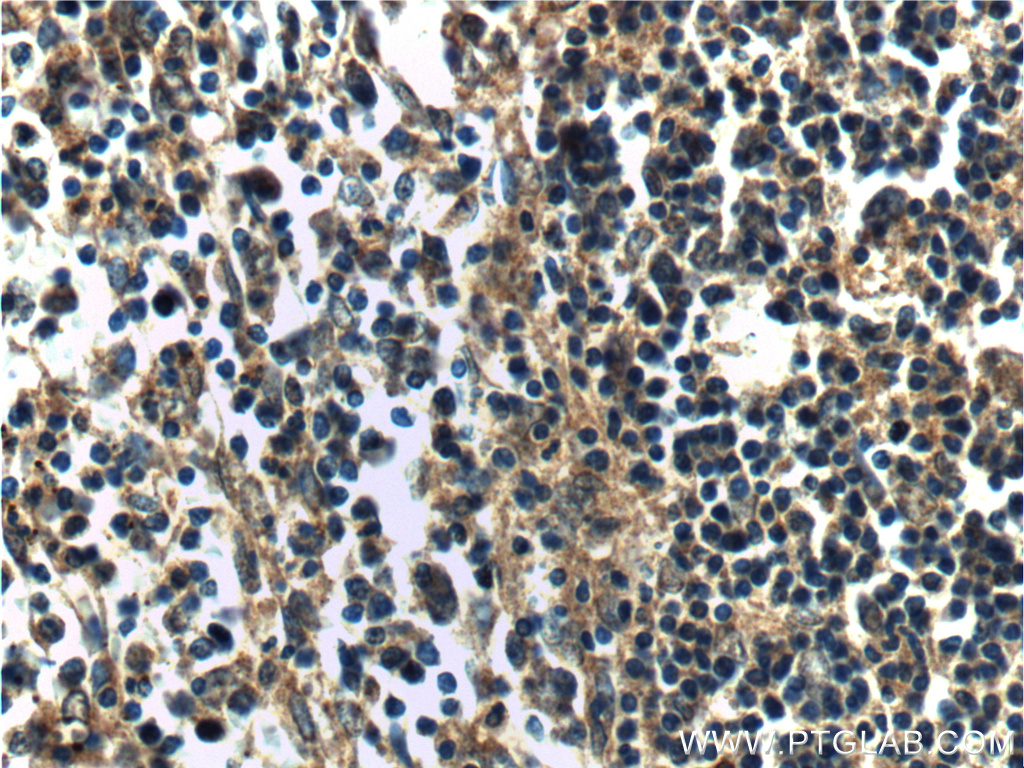 IHC staining of human spleen using 19970-1-AP