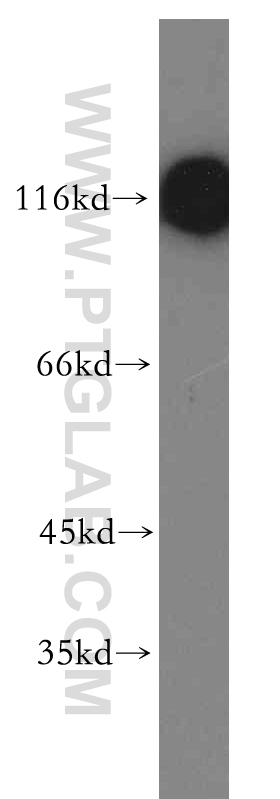 WB analysis of human skeletal muscle using 19974-1-AP